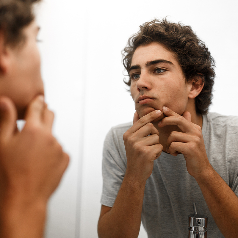 teenager with pimples in front of the mirror