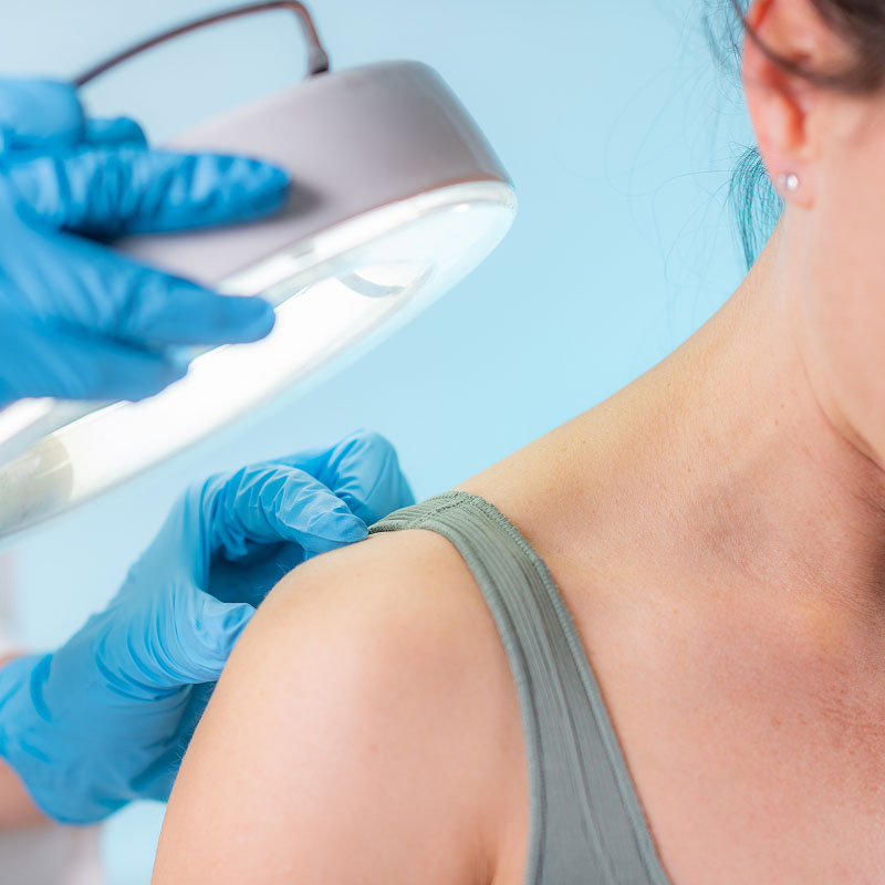Skin diagnosis