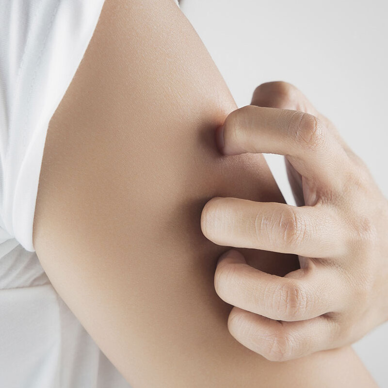 a woman itching her arm