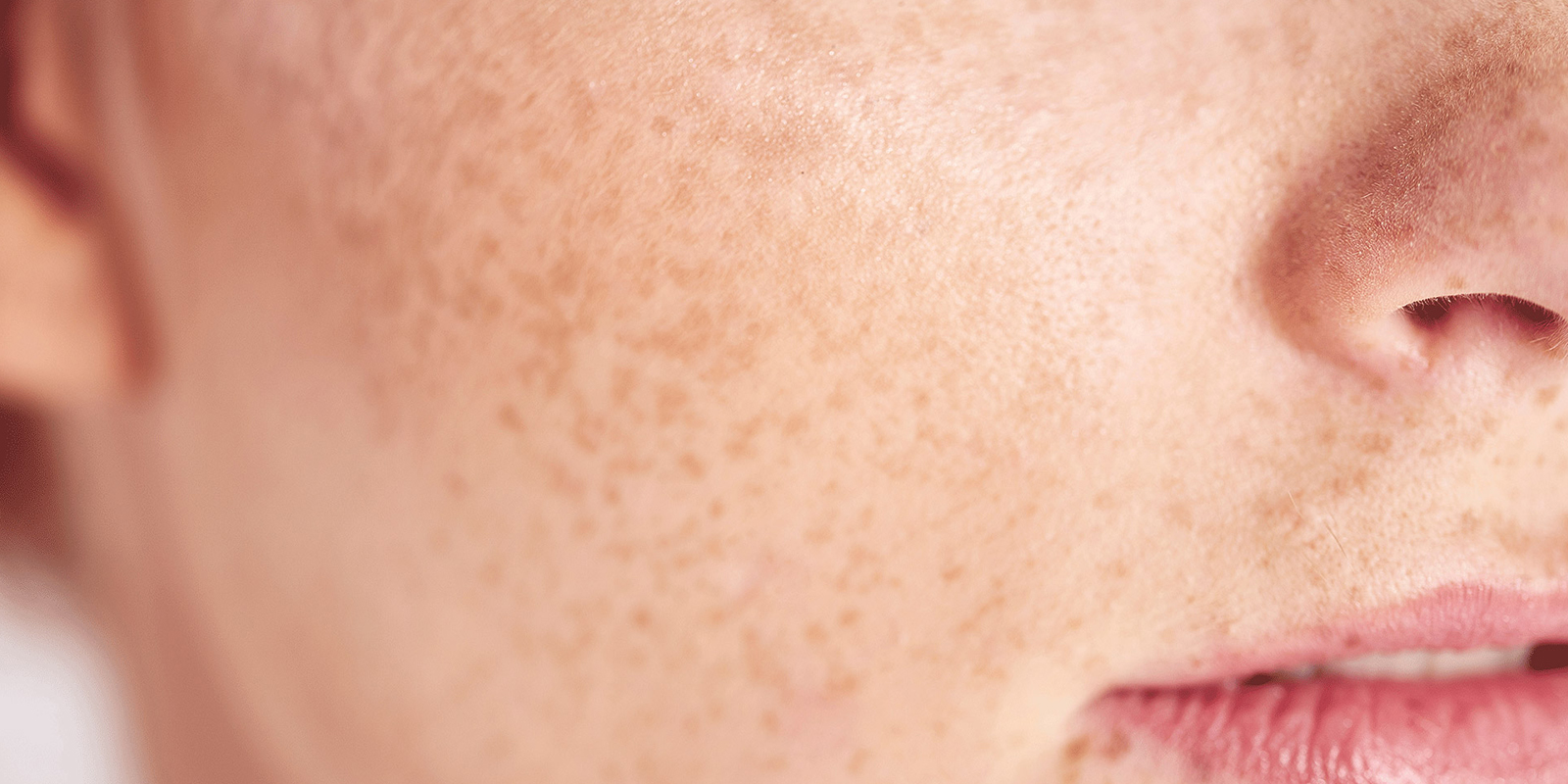 Sensitive skin