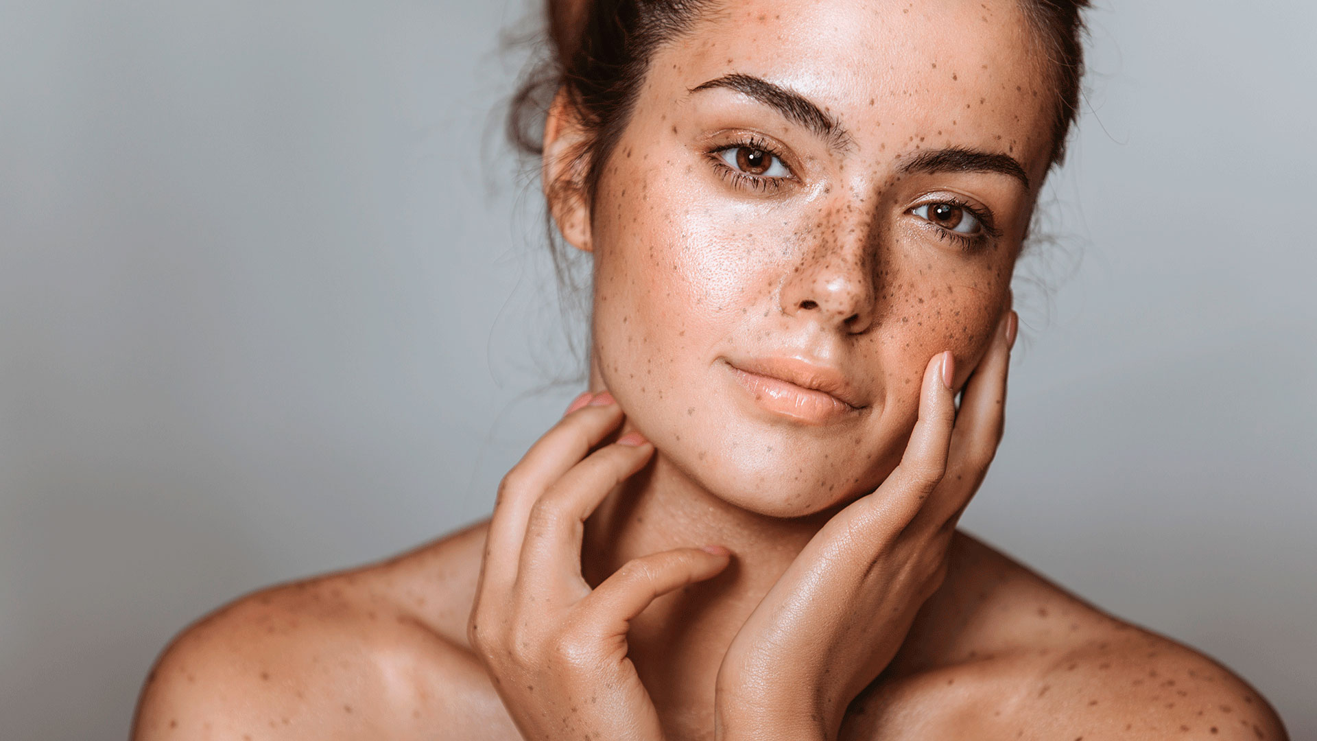 Understanding Dark Spots on Face: Causes and Solutions | BIODERMA