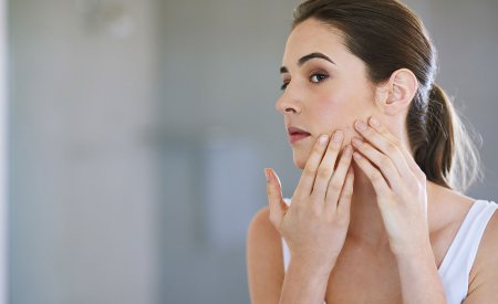 oily pimple skin treatment