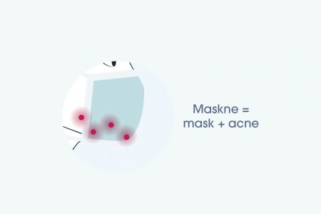 Maskne_maskne